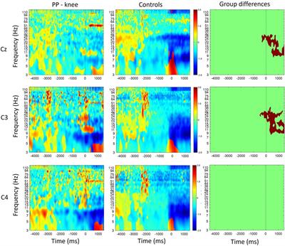 EEG signatures of low back and knee joint pain during movement execution: a short report